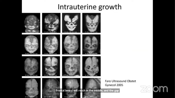 Craniofacial  - Full session