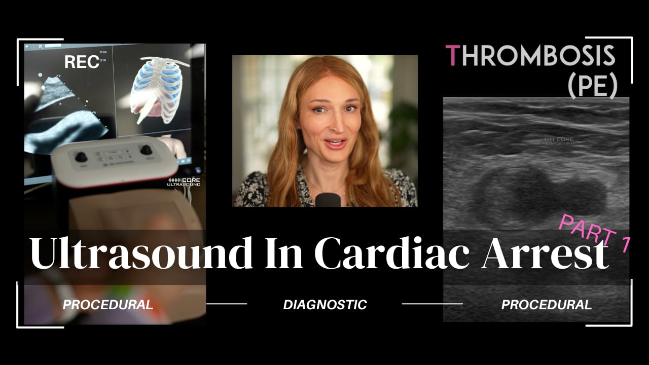 Image of Cardiac Arrest Update 2024 (Part 1)