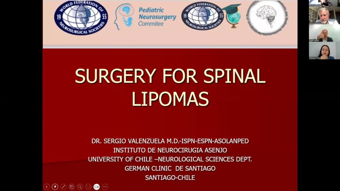 Surgery for Spinal Lipomas