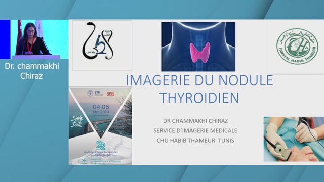 IMAGERIE DU NODULE THYROIDIEN