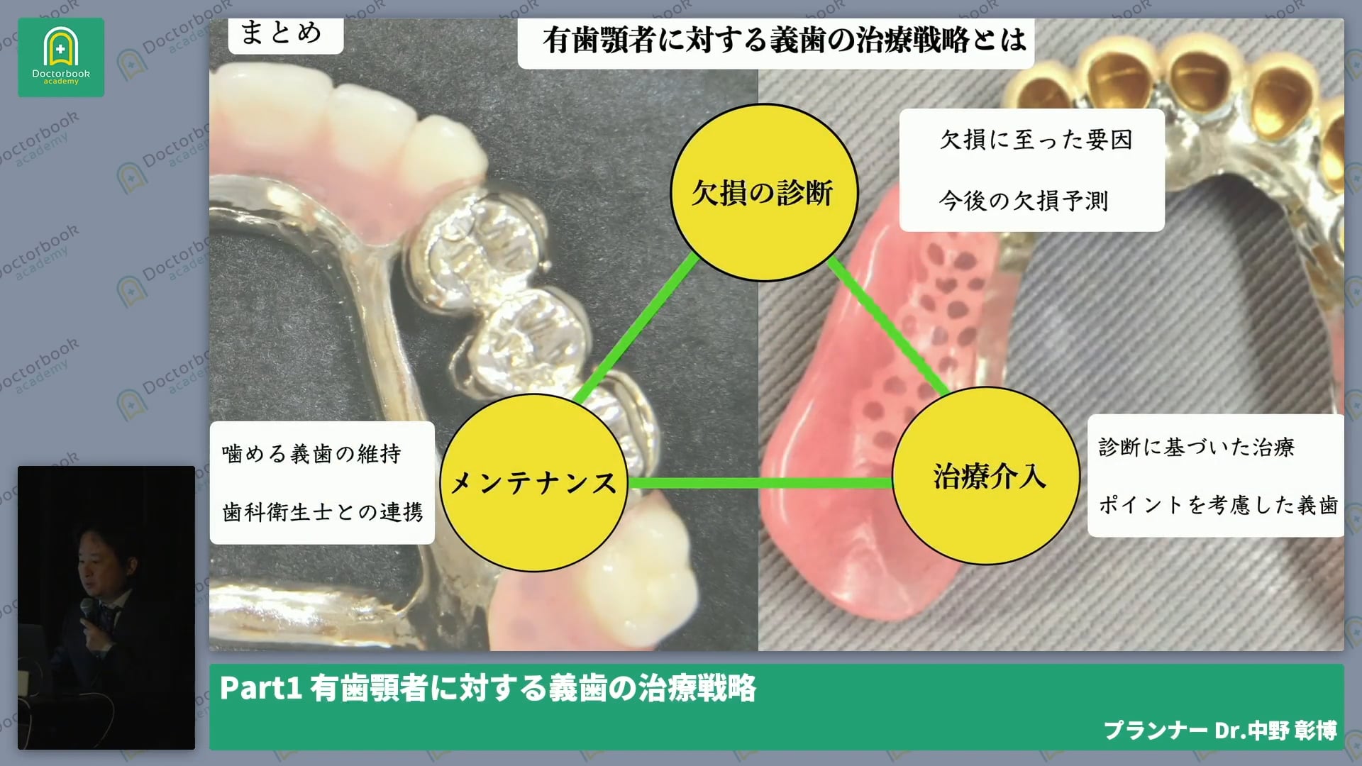 有歯顎者に対する義歯の戦略 -総括- 中野 彰博先生