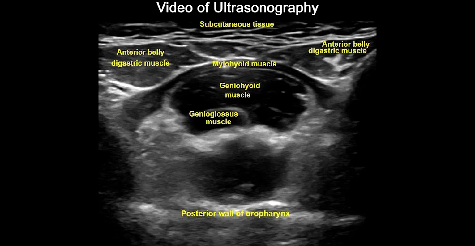 Ultrasonography of the tongue