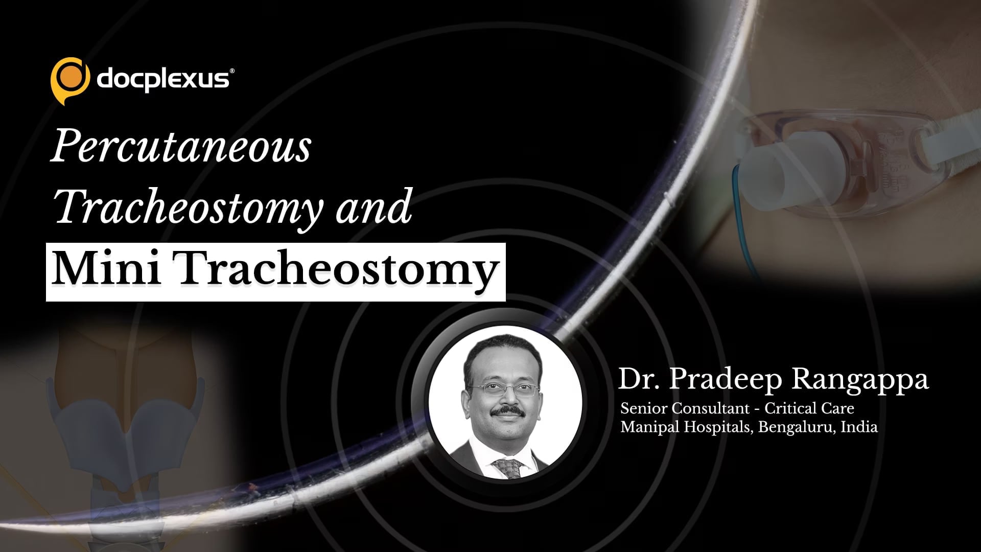 Percutaneous Tracheostomy and Mini Tracheostomy