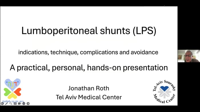 Lumboperitoneal Shunts (LPS)