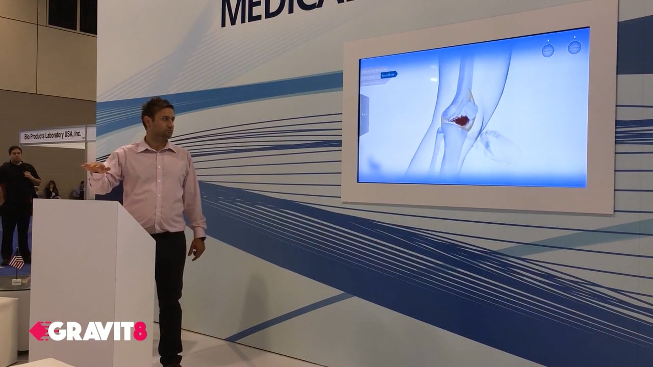 Video poster