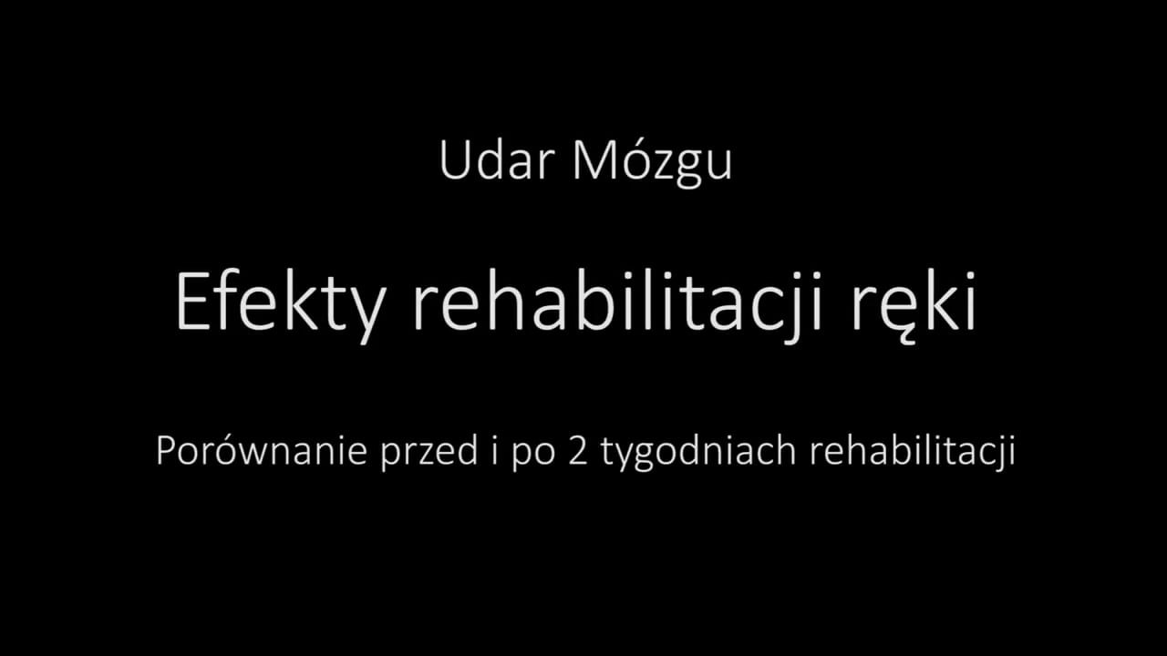 Rehabilitacja ręki po udarze — efekty ćwiczeń