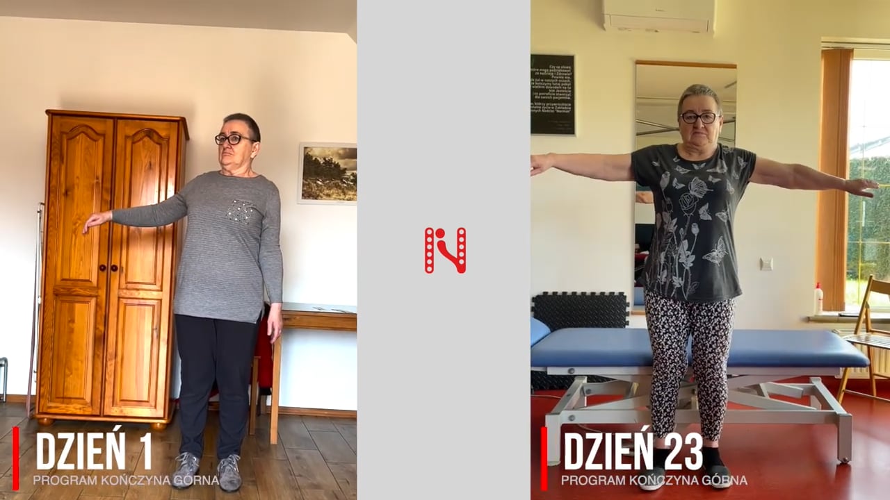 Rehabilitacja ręki po udarze