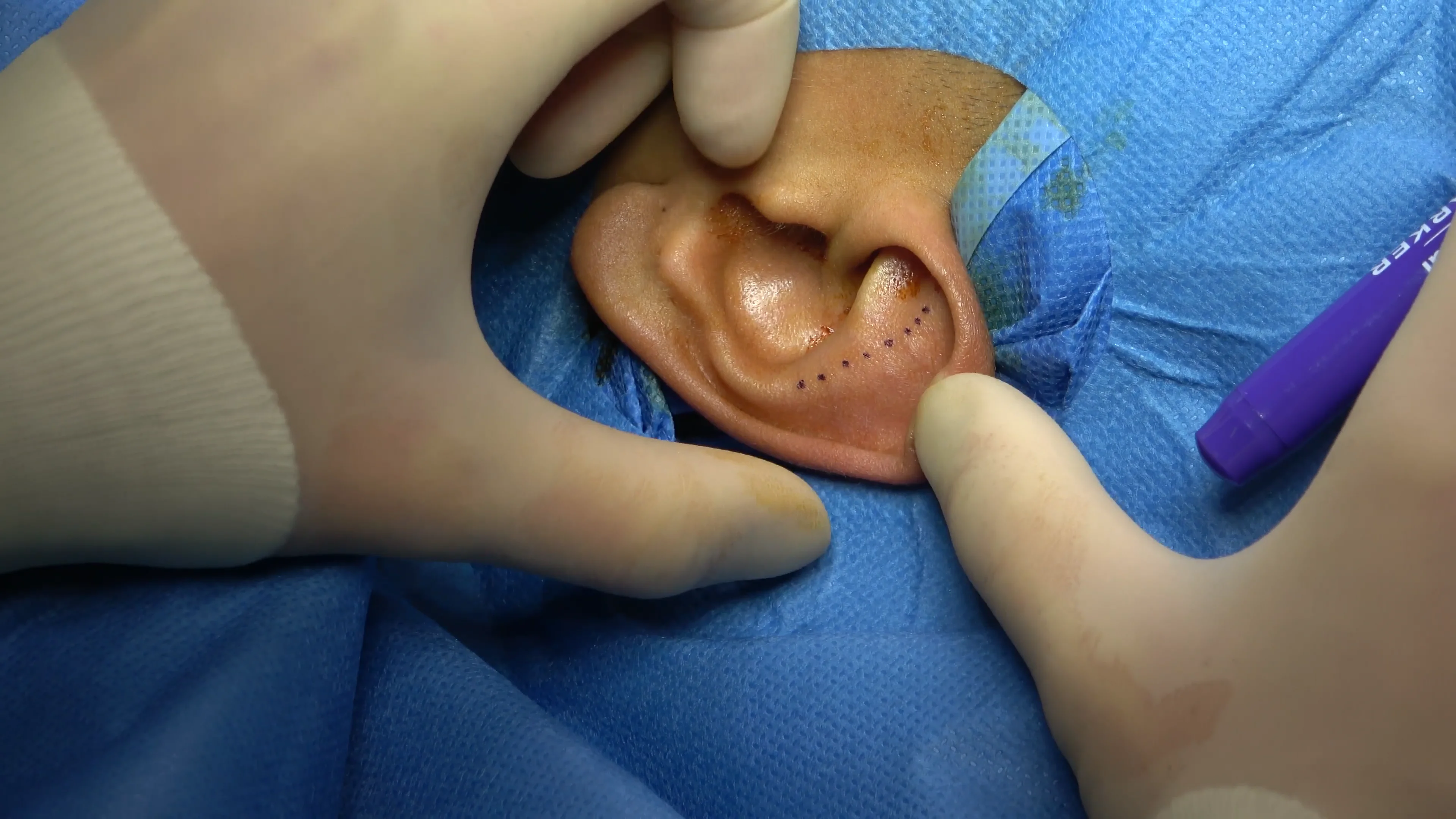 The Journal of Laryngology & Otology | Cambridge Core
