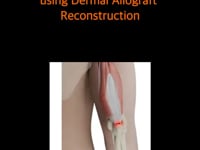 Vimeo video – thumbnail