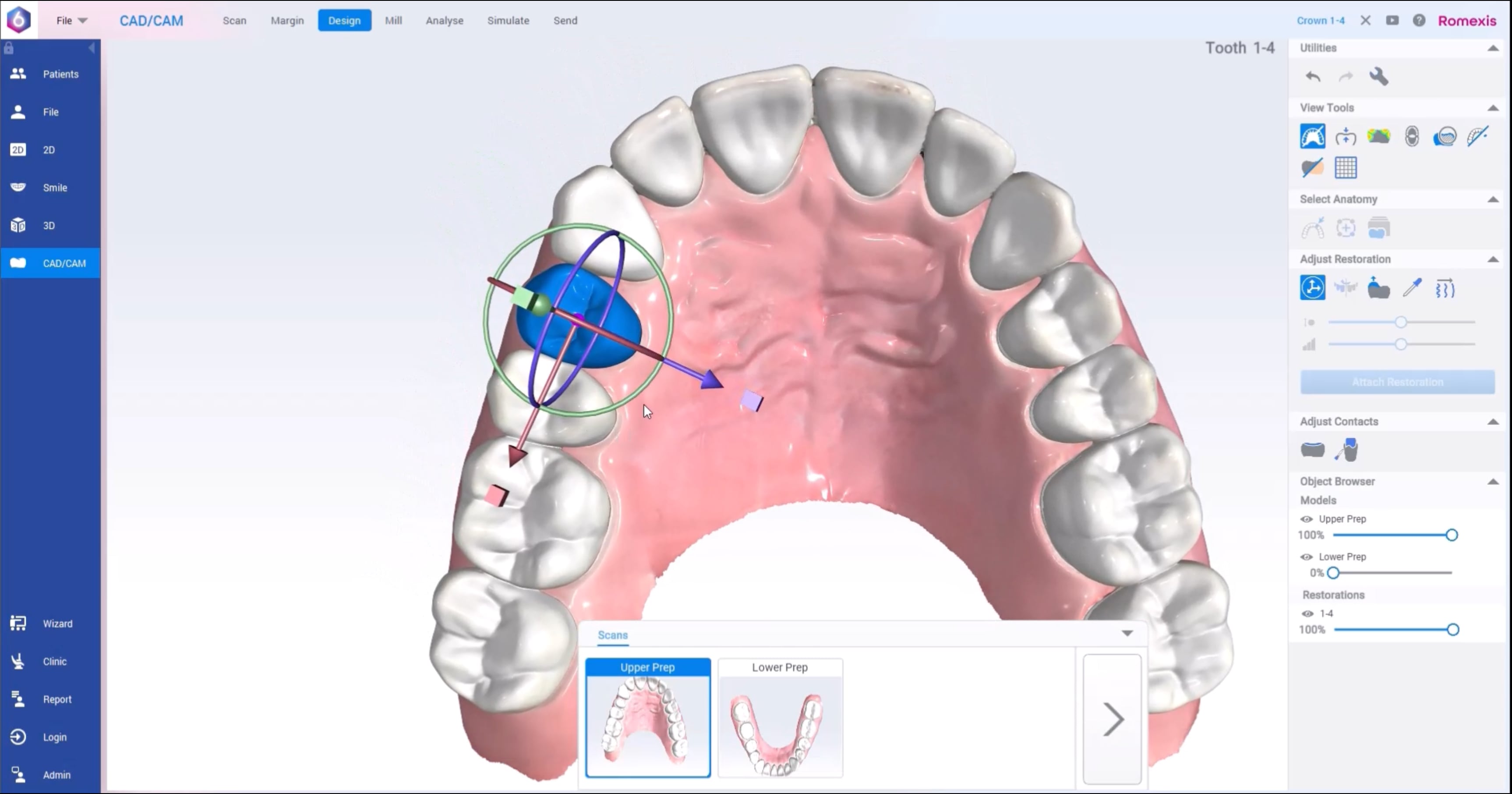 How to – Design a restoration using teeth library in the CAD/CAM module ...