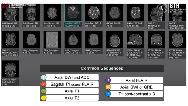 Clés d'interprétation de l'imagerie du crane