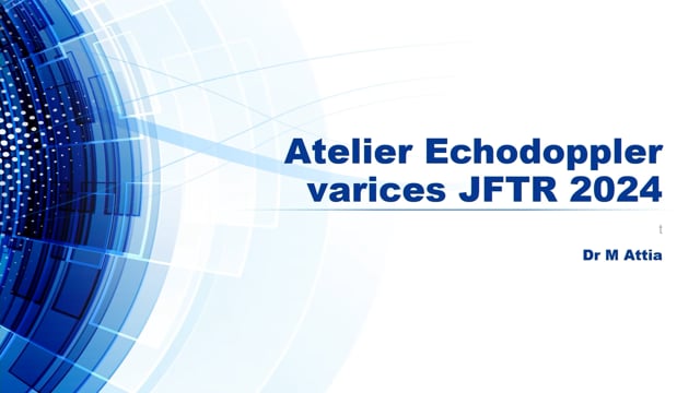 Écho-Doppler des varices des membres inférieurs