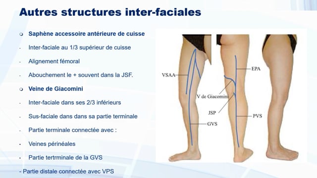Écho-Doppler des varices des membres inférieurs