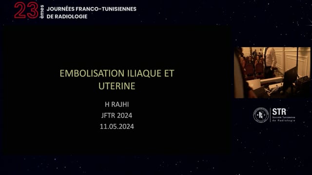 Embolisation iliaque et utérine (atelier sur simulateur)