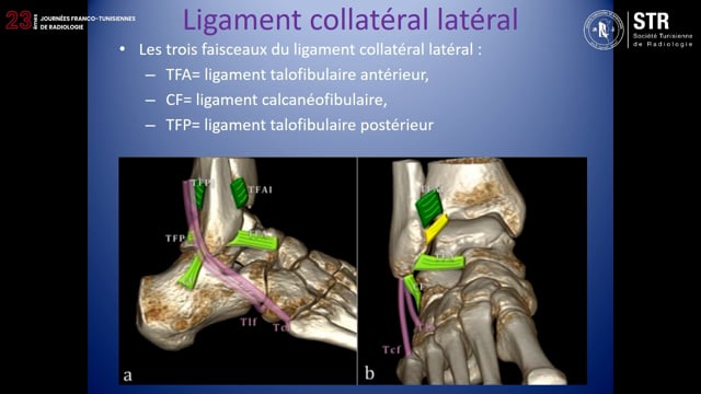 Échographie de la cheville (partie 2)
