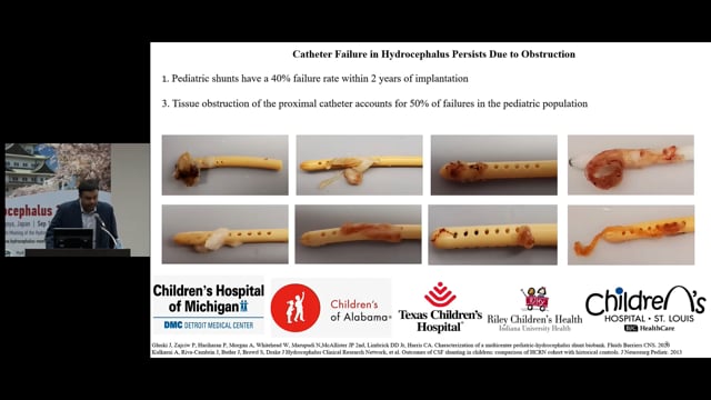 Analyzing Fluid Dynamic Patterns in Ventricular Catheters for Pediatric Hydrocephalus - Christopher Roberts
