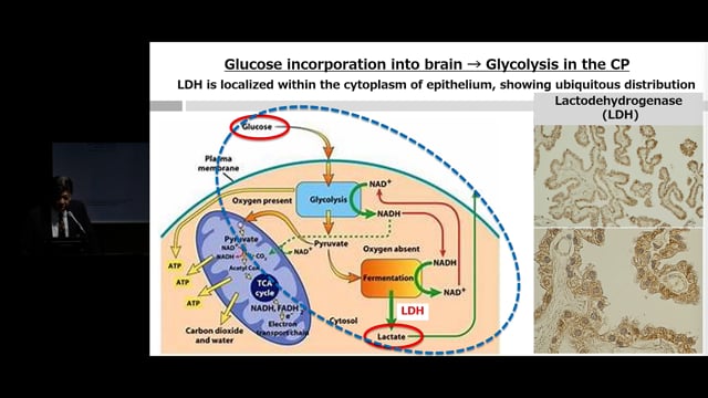New mechanism hypothesis of Maillard reaction-mediated cerebrospinal production at the choroid plexus - Yasuhiko Hayashi