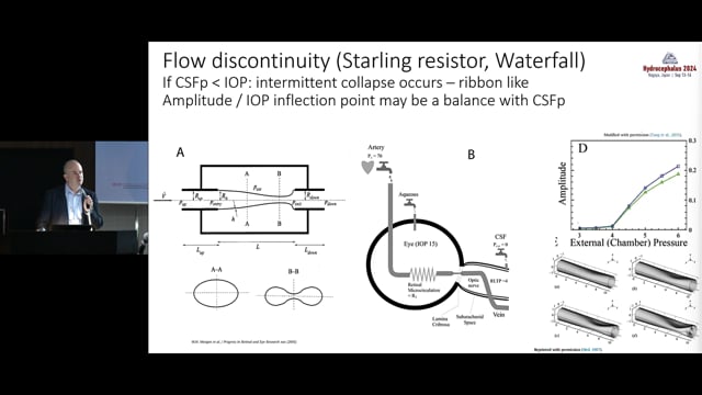 Non-invasive intracranial pressure estimation using retinal photoplethysmography - William Morgan