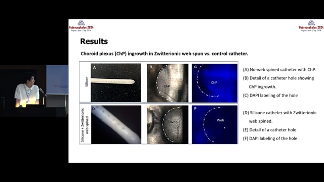 Zwitterionic-Coating for Mitigating Cellular Occlusion on a Ventricular Catheter for the Treatment of Hydrocephalus - Seunghyun