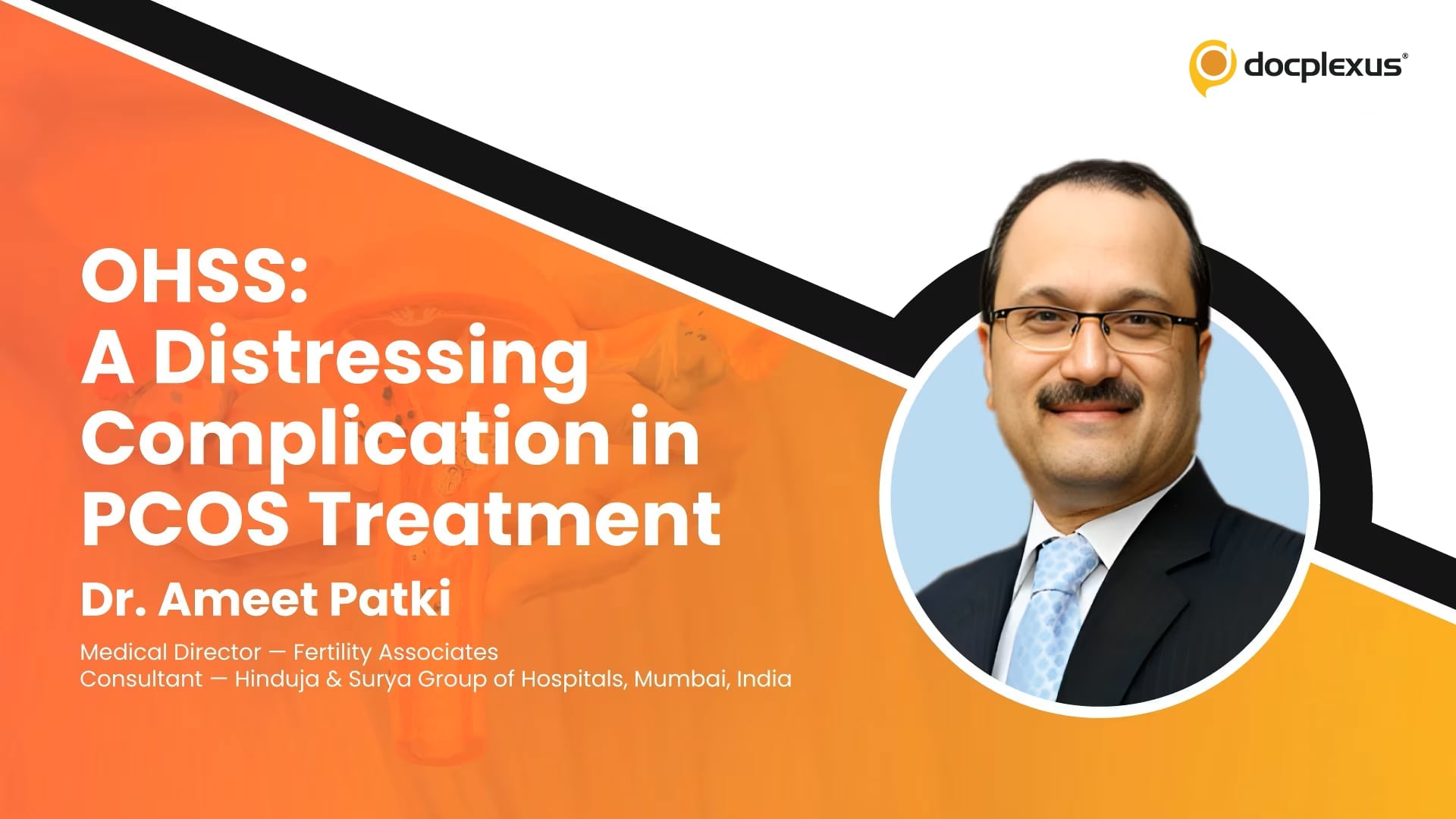 OHSS: A Distressing Complication in PCOS Treatment