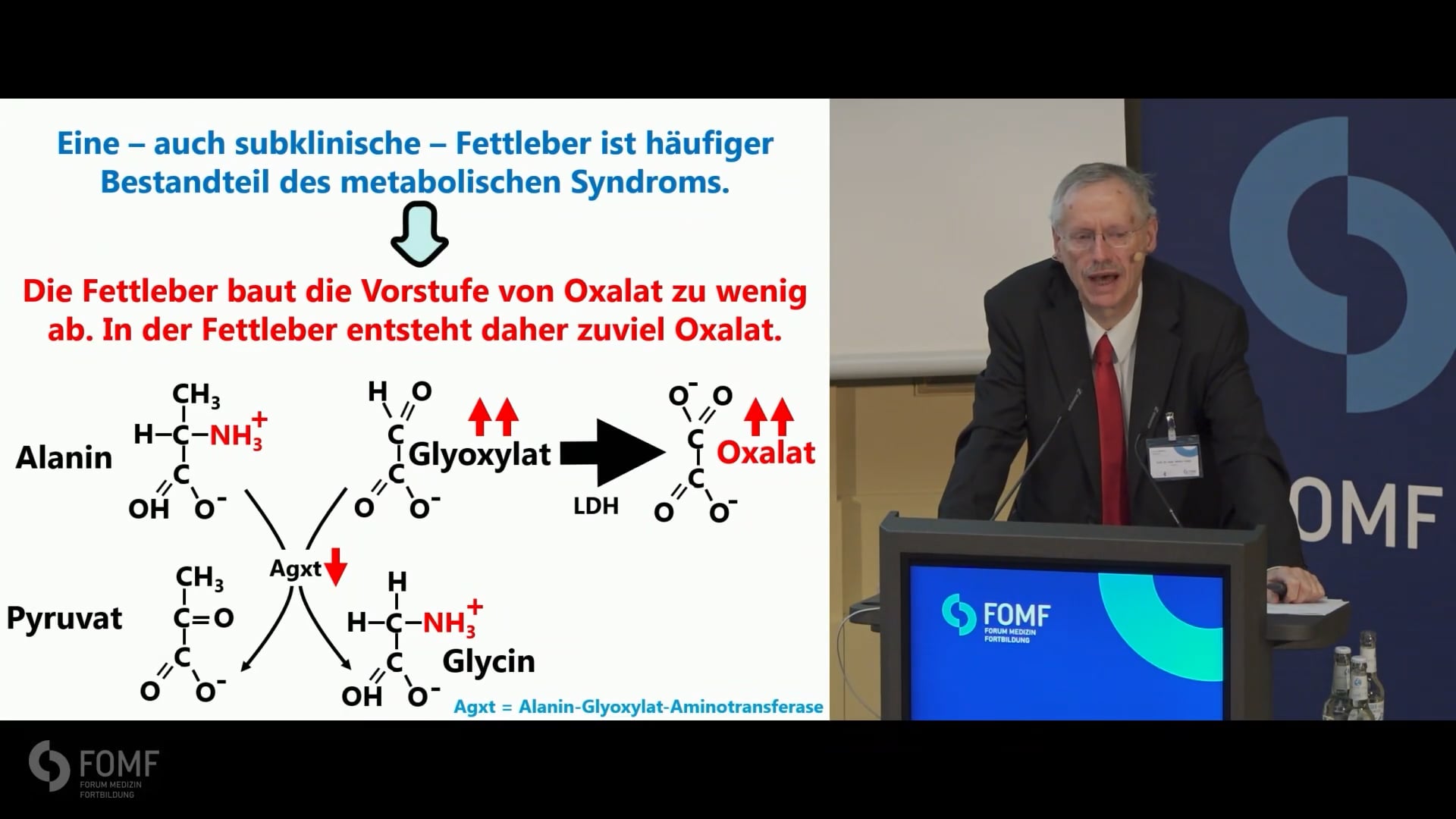 Prävention und Management von Nierensteinen