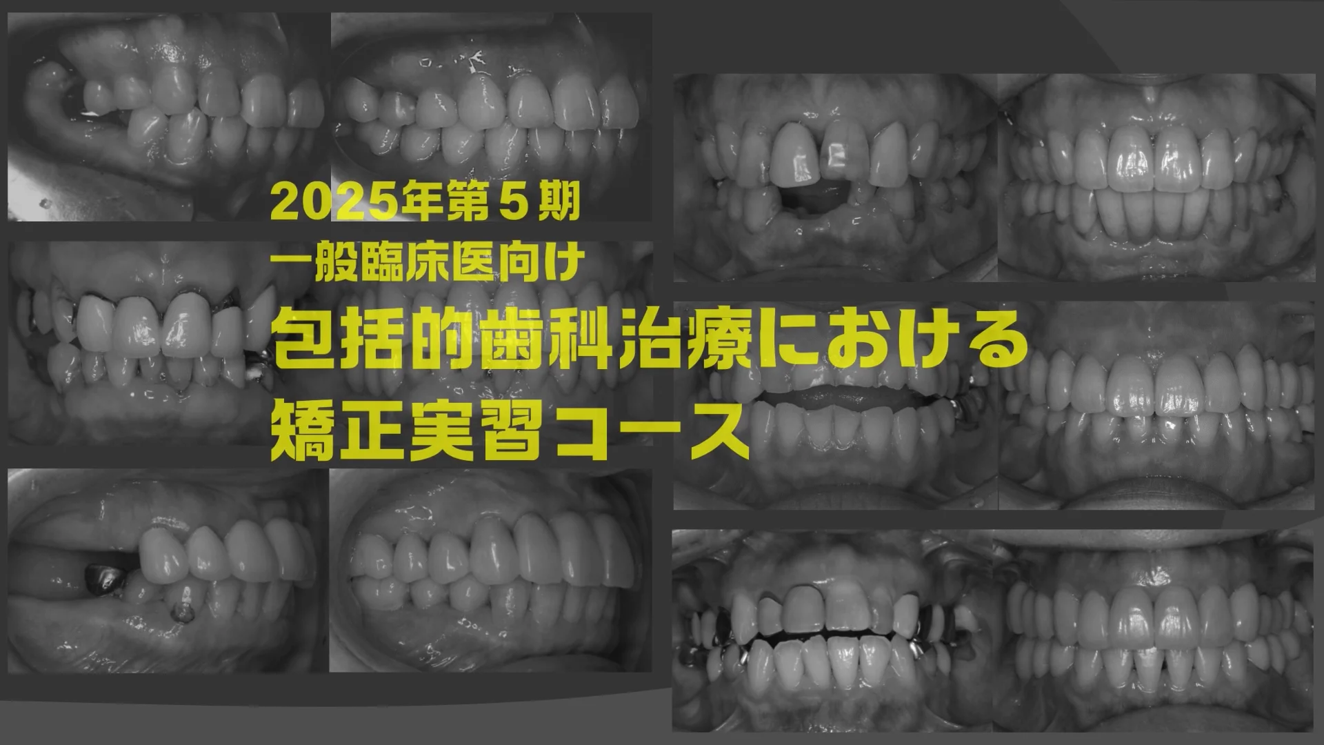 インターディシプリナリーコース | 歯科矯正セミナー