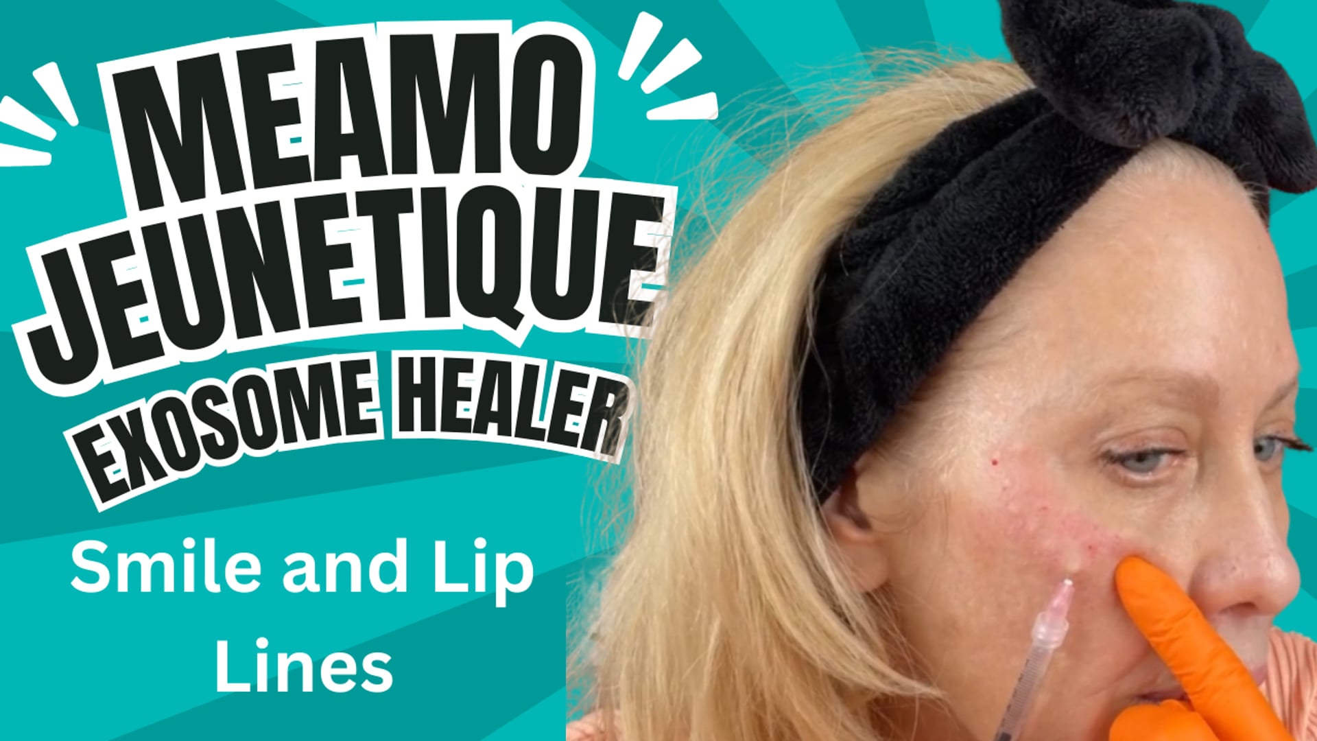 Jeunetique Exo Smile & Lips Lines