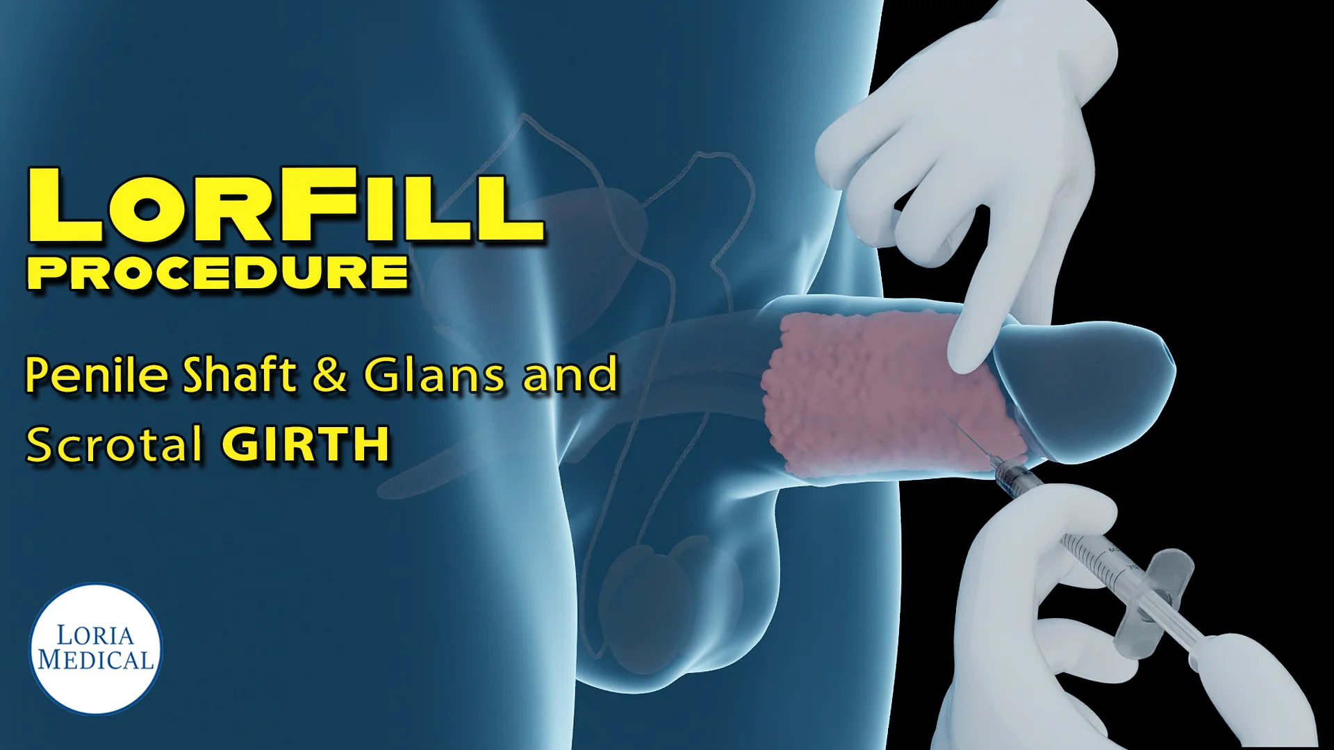 Yuz erkak va bir ayol porno