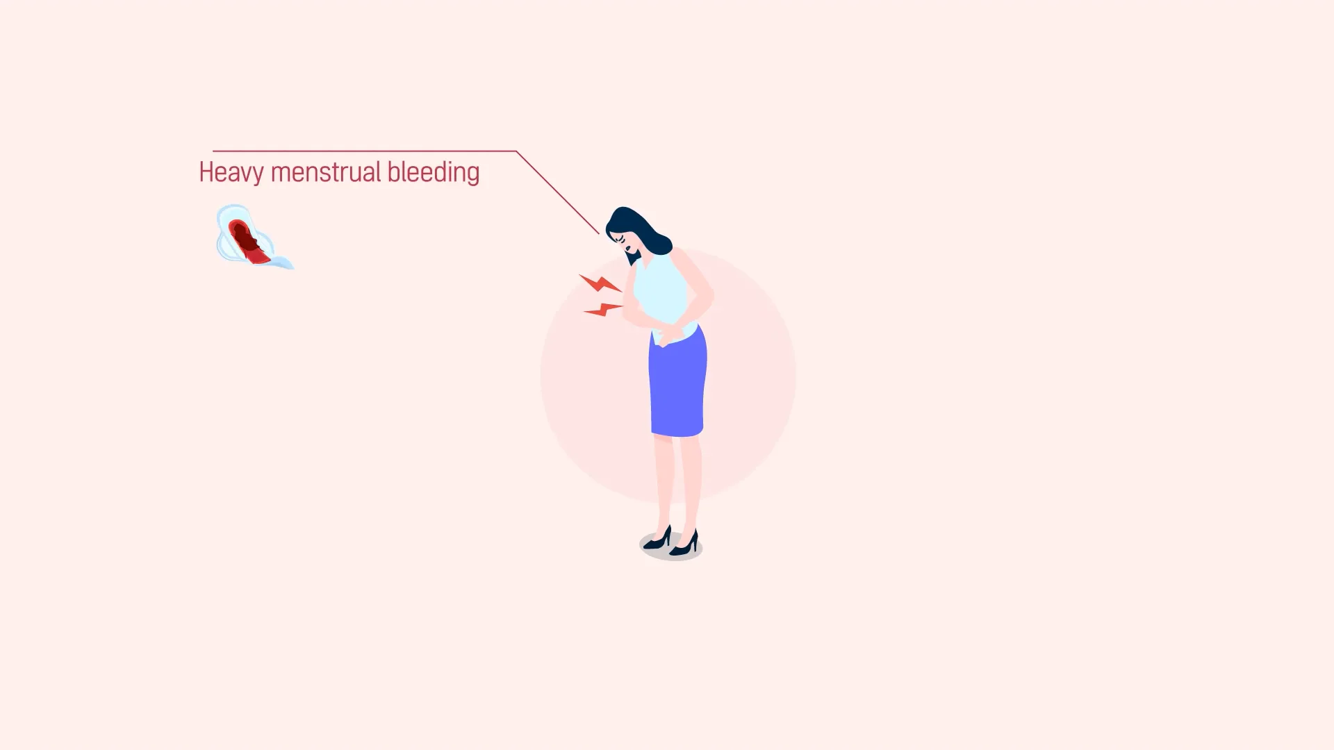 STARmed Uterine Fibroid Procedure, image size:1920x1080