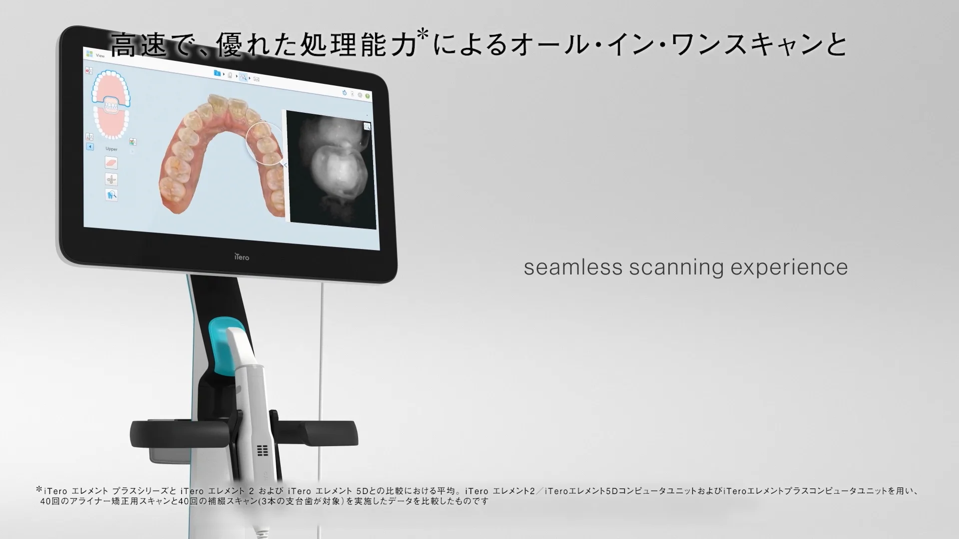 Expand your possibilities – iTero エレメント5Dプラスで広がる