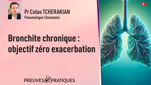 Bronchite chronique : objectif zéro exacerbation