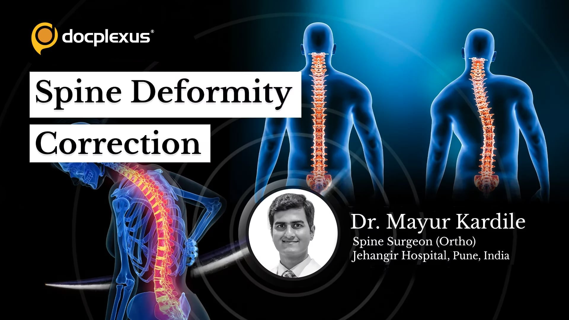Spine Deformity Correction