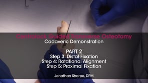 Centrolock® Partie 2 – Démonstration sur cadavre