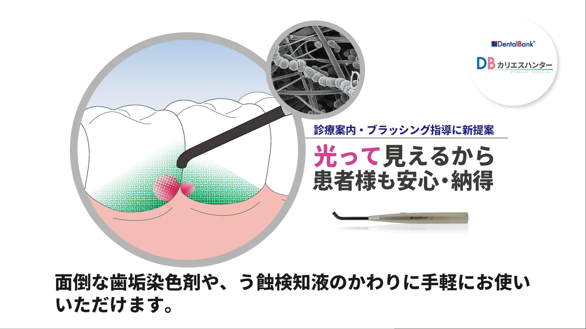 すきっ歯 歯間のお掃除しま専科細強(サイキョー)フロス 【3個セット】OB