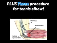 Vimeo video – thumbnail