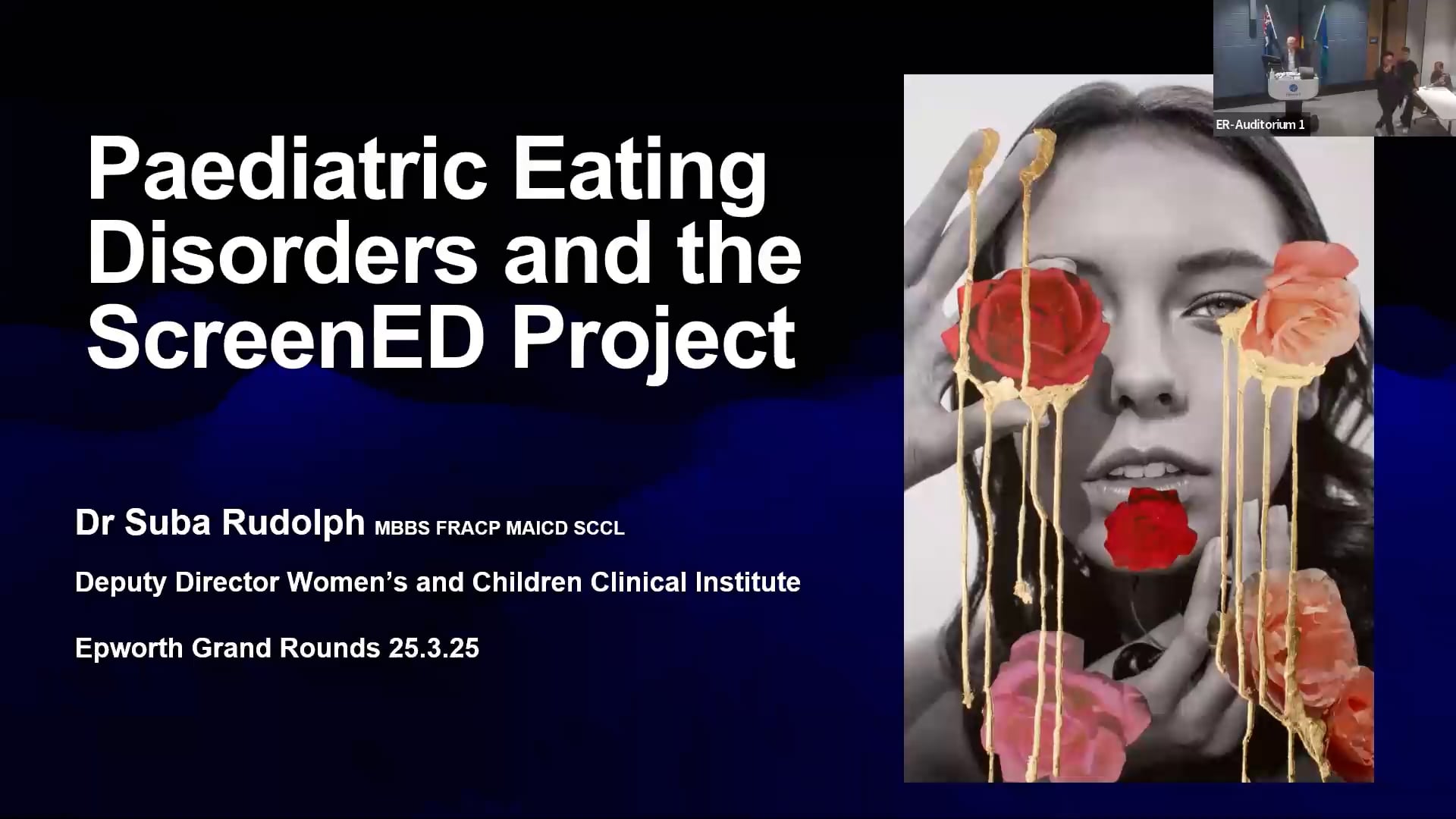 Epworth Grand Rounds Videos - Epworth Grand Round 25/03/2025 ...