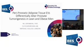 Symposium 3: The adipose microenvironment: the missing link between obesity and cancer?: Talk 2