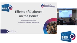 Symposium 1: Disorders of bone mineral density - mechanisms, consequences and management: Talk 1