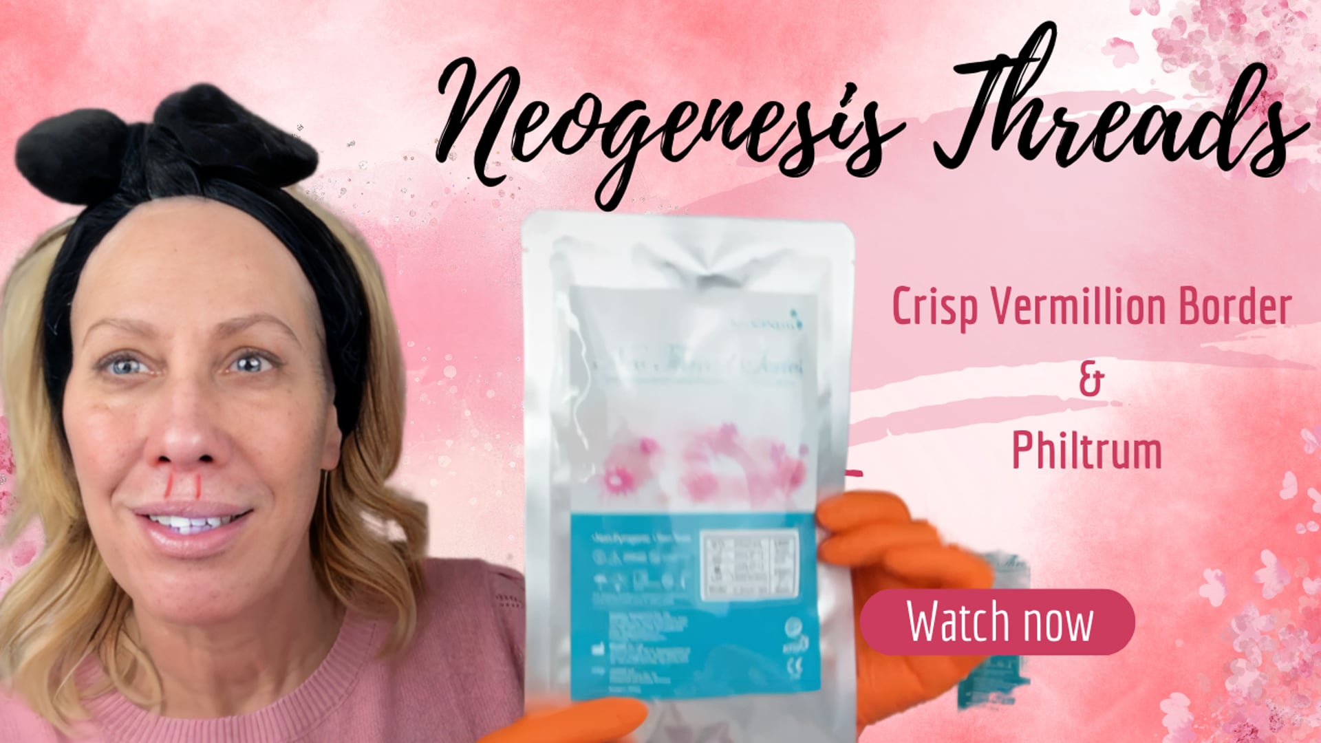 Crisp My Vermillion Border with Screw Threads