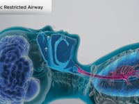 Pediatric Restricted Airway