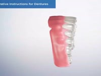 Post-Operative Instructions for Dentures