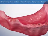 Post-Operative Instructions for Immediate Dentures