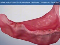 Post-Operative Instructions for Immediate Dentures