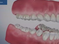 Equilibration