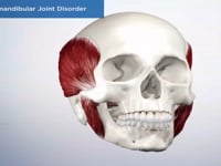 Temporomandibular Joint Disorder