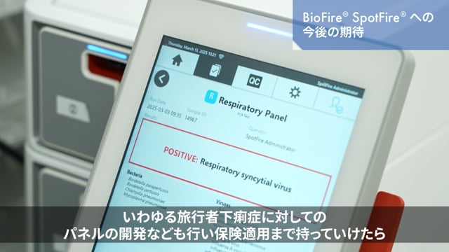 SpotFire Users voice 3