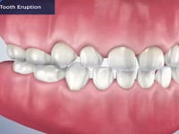 Pediatric Tooth Eruption