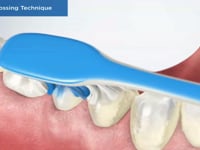 Proper Flossing Technique