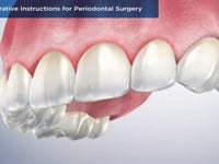 Post-Operative Instructions for Periodontal Surger