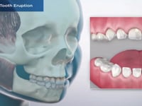 Pediatric Tooth Eruption